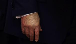 Аспирин, скенер и сън: Въпросите около здравето на Тръмп