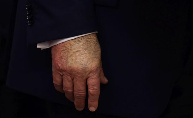 Аспирин, скенер и сън: Въпросите около здравето на Тръмп