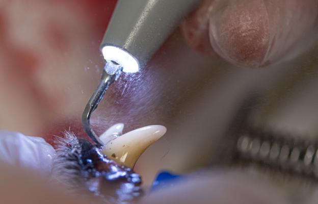 куче зъби почистване