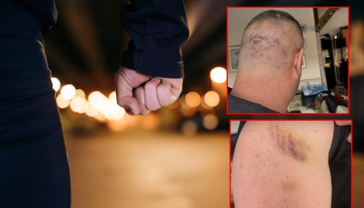 a - МЕЛЕ В ДИСКОТЕКА! Мъж твърди, че е връзван с белезници и жестоко бит