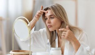 Менопаузата и акнето: "Твърде млади за бръчки, твърде стари за пъпки“