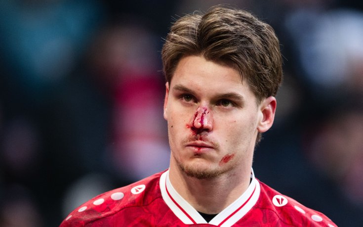 Защитник на Щутгарт ще играе със счупен нос в Лига Европа