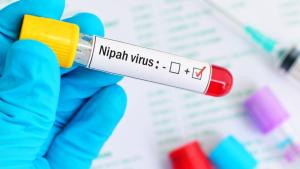 вирус нипа
