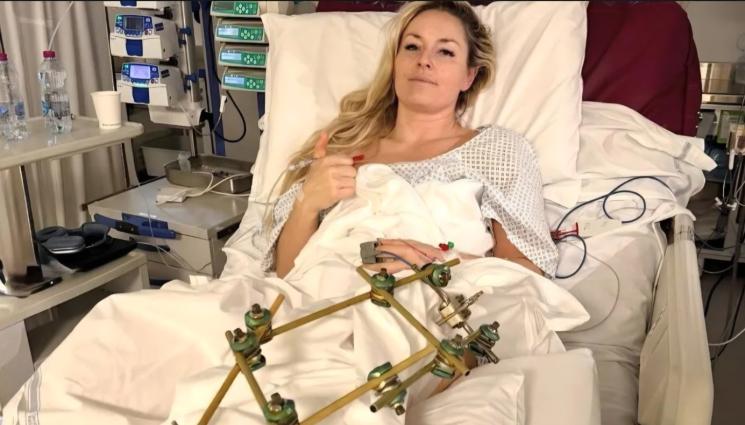 Линзи Вон - Линдзи Вон разкри със снимка защо се налага да носи метален фиксатор след третата поредна операция