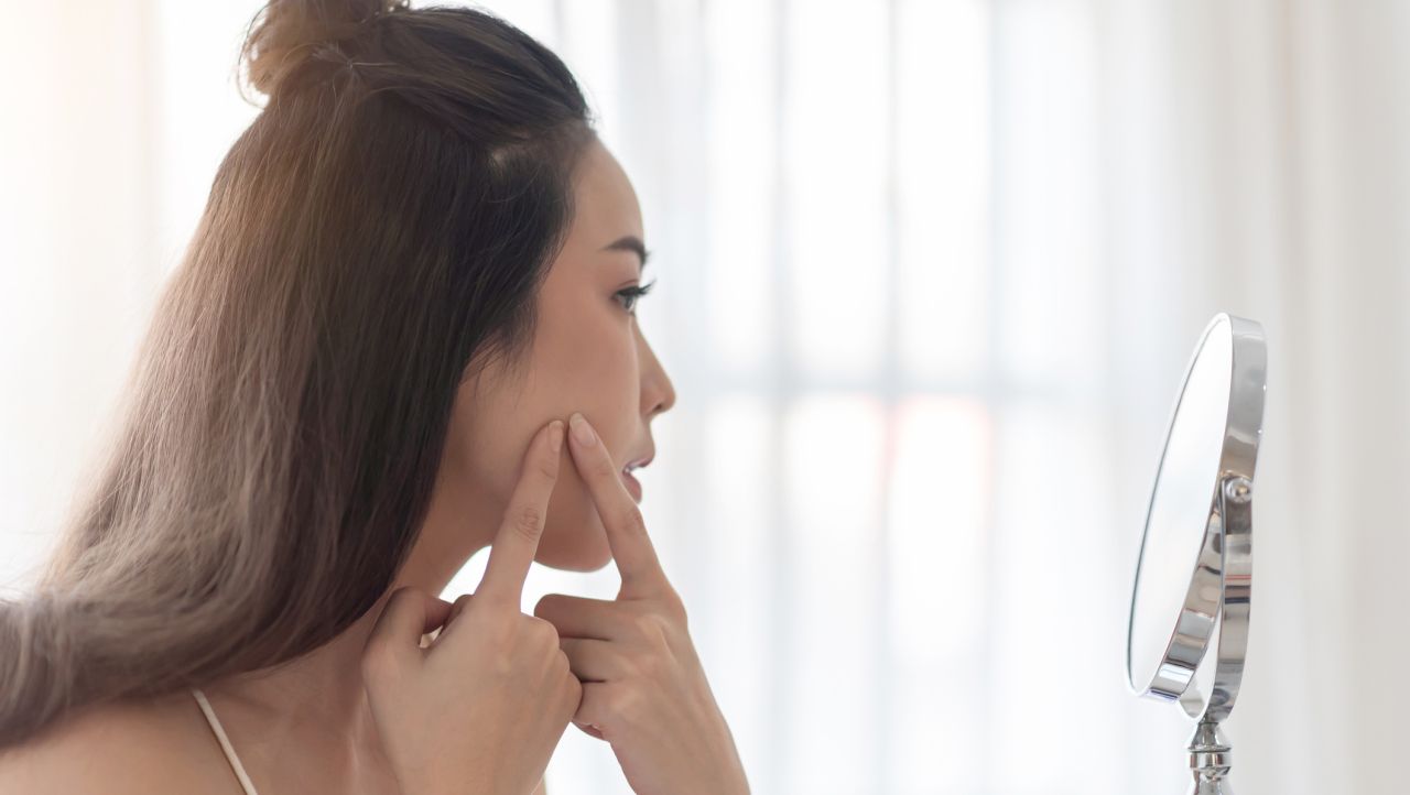 Спрете да правите това: Кои методи срещу черни точки са много вредни за кожата