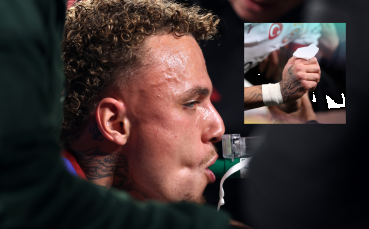 Ужасяващо: Играч загуби част от пръста си в ШЛ (видео)