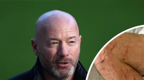 Алън Шиърър