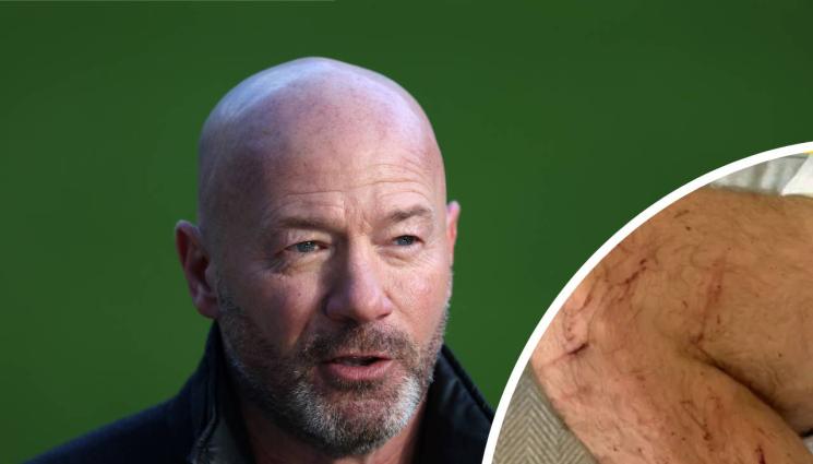 Алън Шиърър - Велосипедни неволи за легендата Шиърър