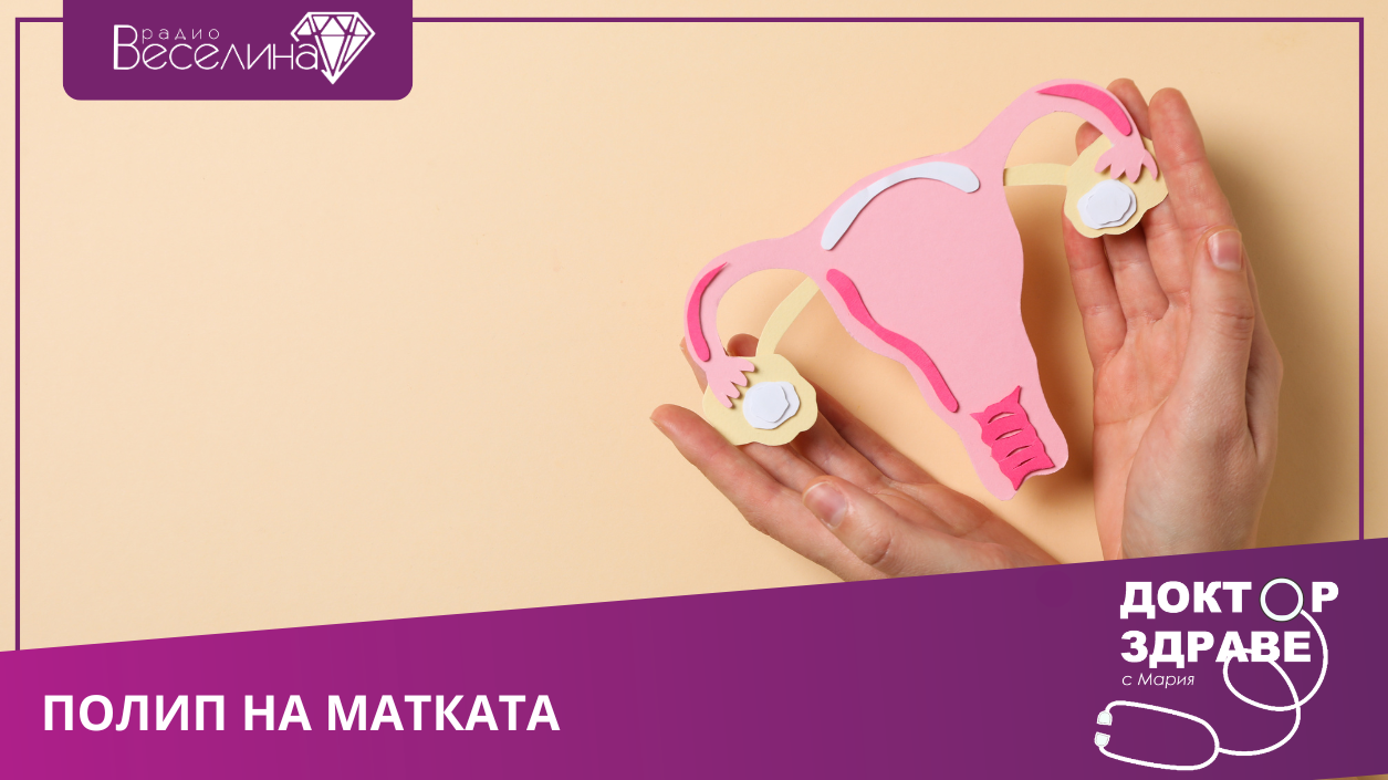 Женско здраве - полип на матката