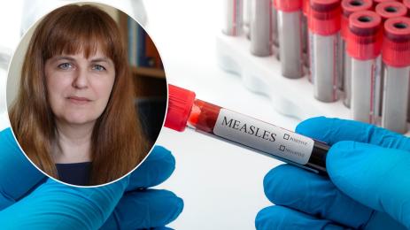 Пармакова морбили