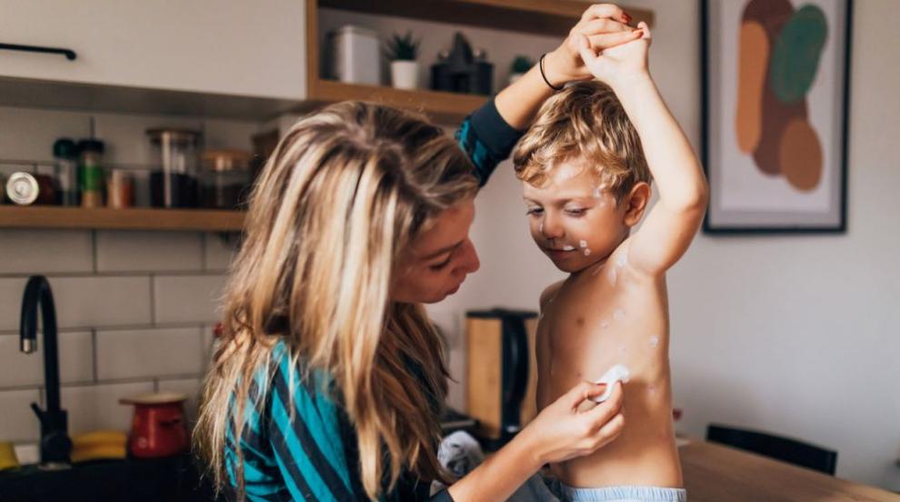 След празниците: Увеличават се случаите на морбили у нас