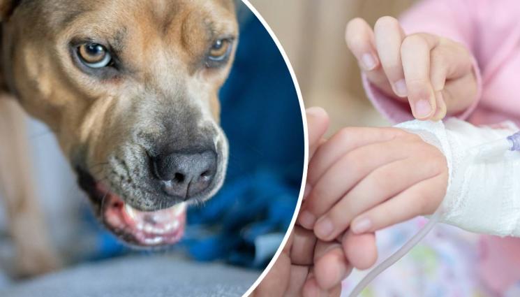 дете болница - Агресивно домашно куче нахапа дете!