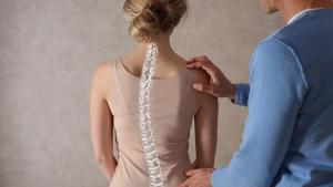 Scoliosis Spine