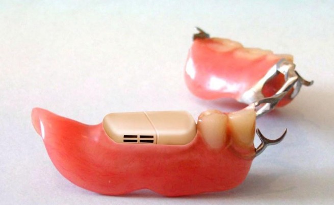 Зъбна протеза... с микрокомпютър