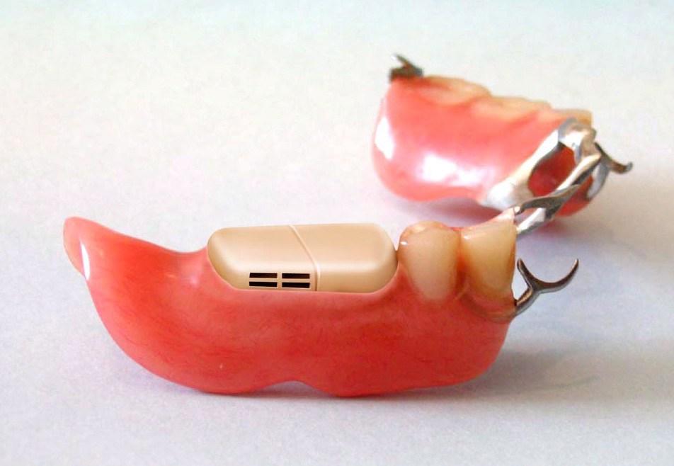 Зъбна протеза... с микрокомпютър