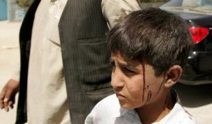 Ранено афганистанско момче при днешния атентат в Кабул