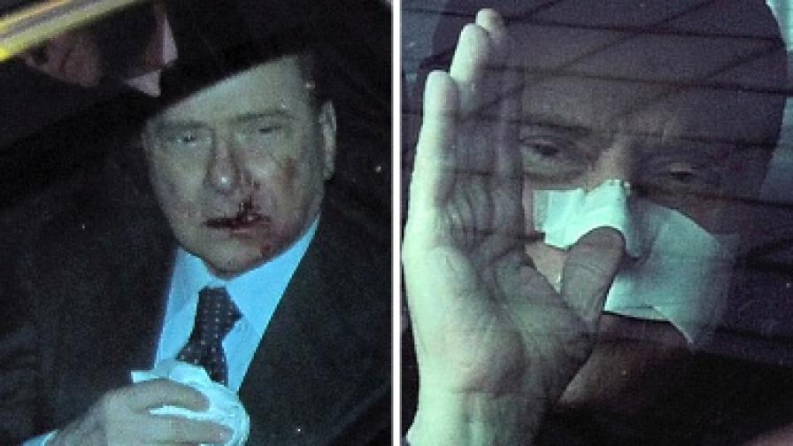Берлускони си тръгна от болницата с превръзка на носа и устата