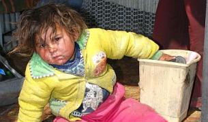 Дребната шарка е най-разпространена в ромските махали