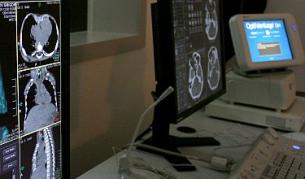 Е-здравеопазването пести пари на държавата