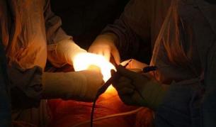 За пръв път в света присадиха цяла изкуствена трахея