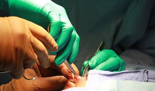 Имплантираха най-малкото изкуствено сърце